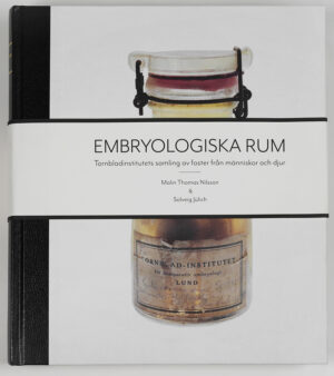 Embryologiska rum : Tornbladinstitutets samling av foster från människor och djur